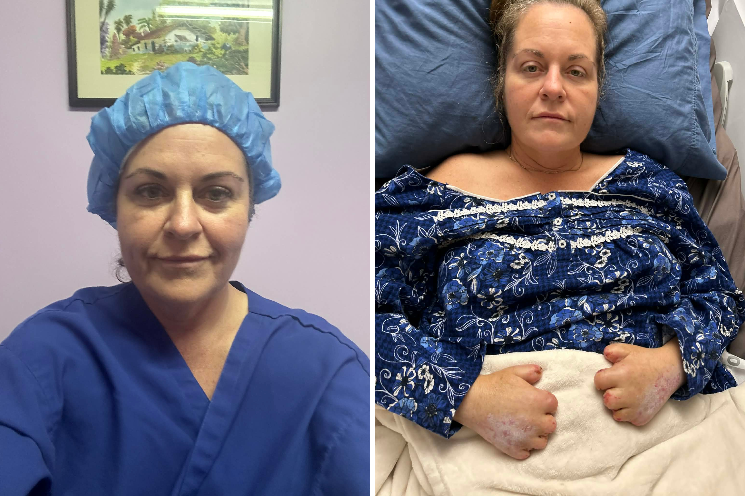 Four Months, 20 Amputations—What Happened After My Surgery Went Wrong