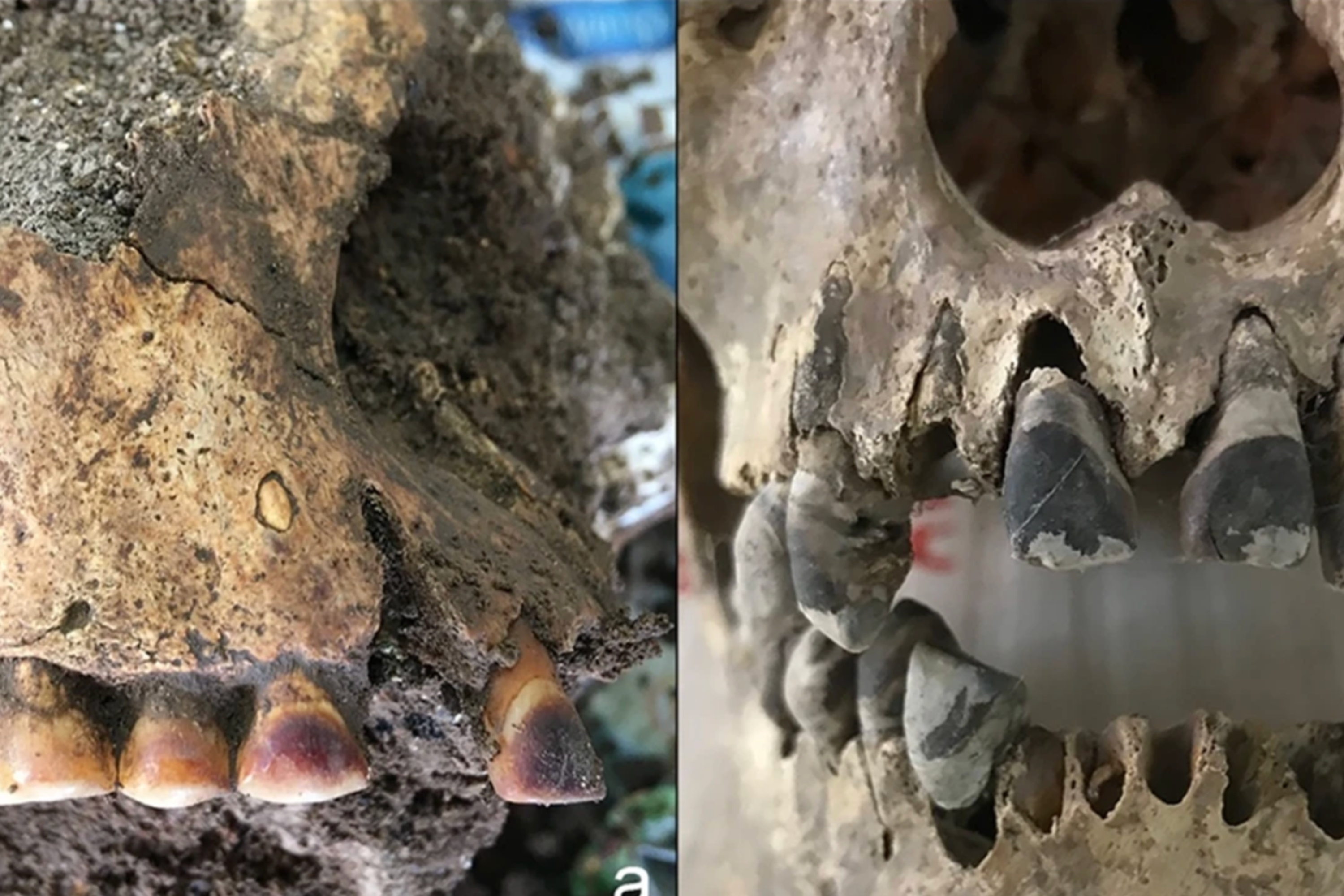 Archaeologists Reveal 2,000-Year-Old Skeleton With All Teeth Dyed Black