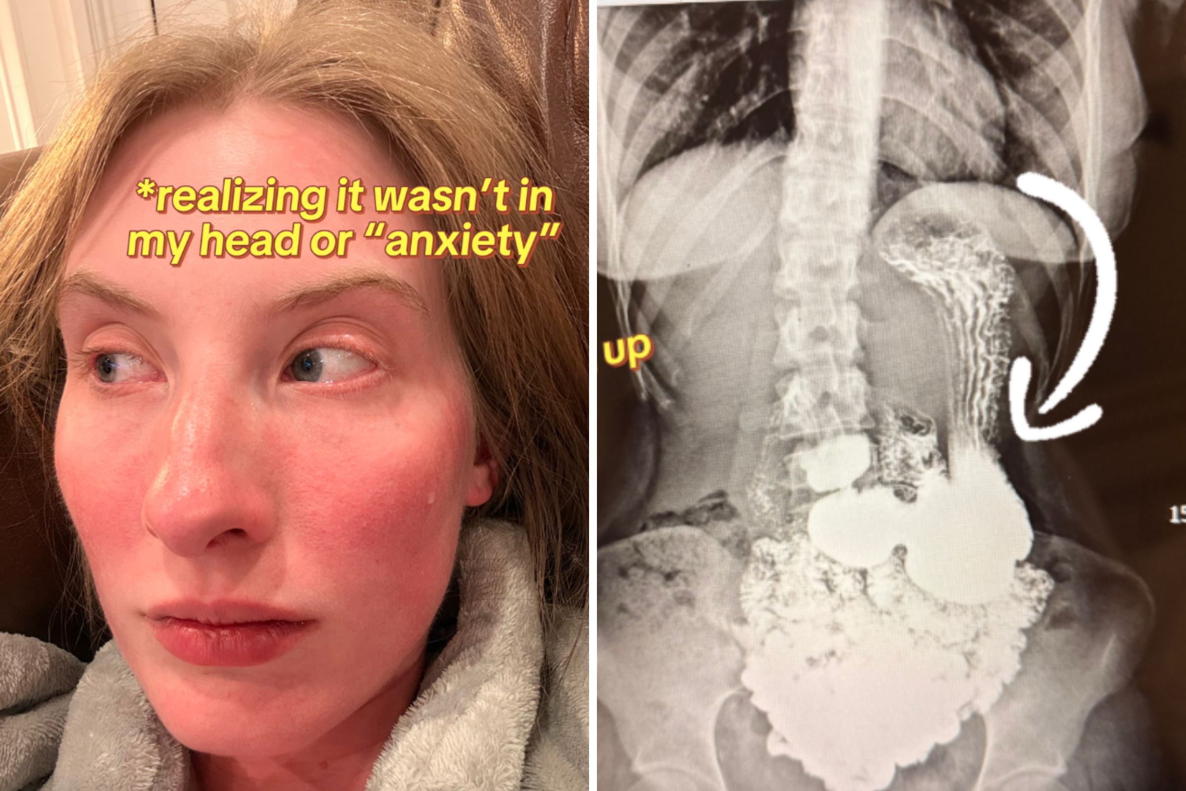 Gen Z Mom Told Symptoms Are ‘All in Her Head’—Left Horrified by Scan