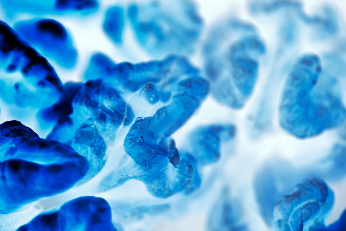 Understanding Preventable Cancer: Lessons from 18.7 Million Cases