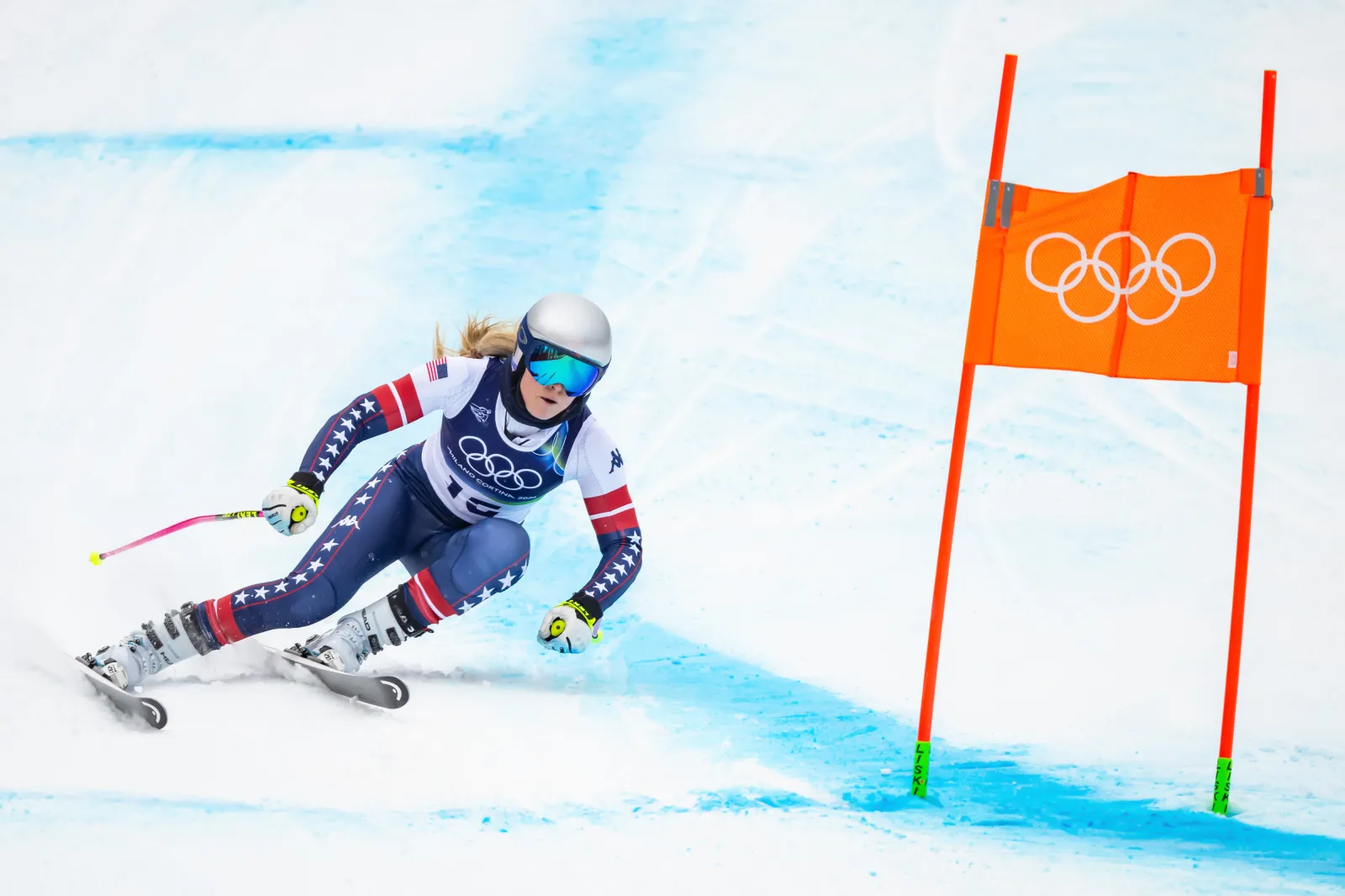 Lindsey Vonn Has Immediate Surgery on Broken Leg After Brutal Olympics Crash