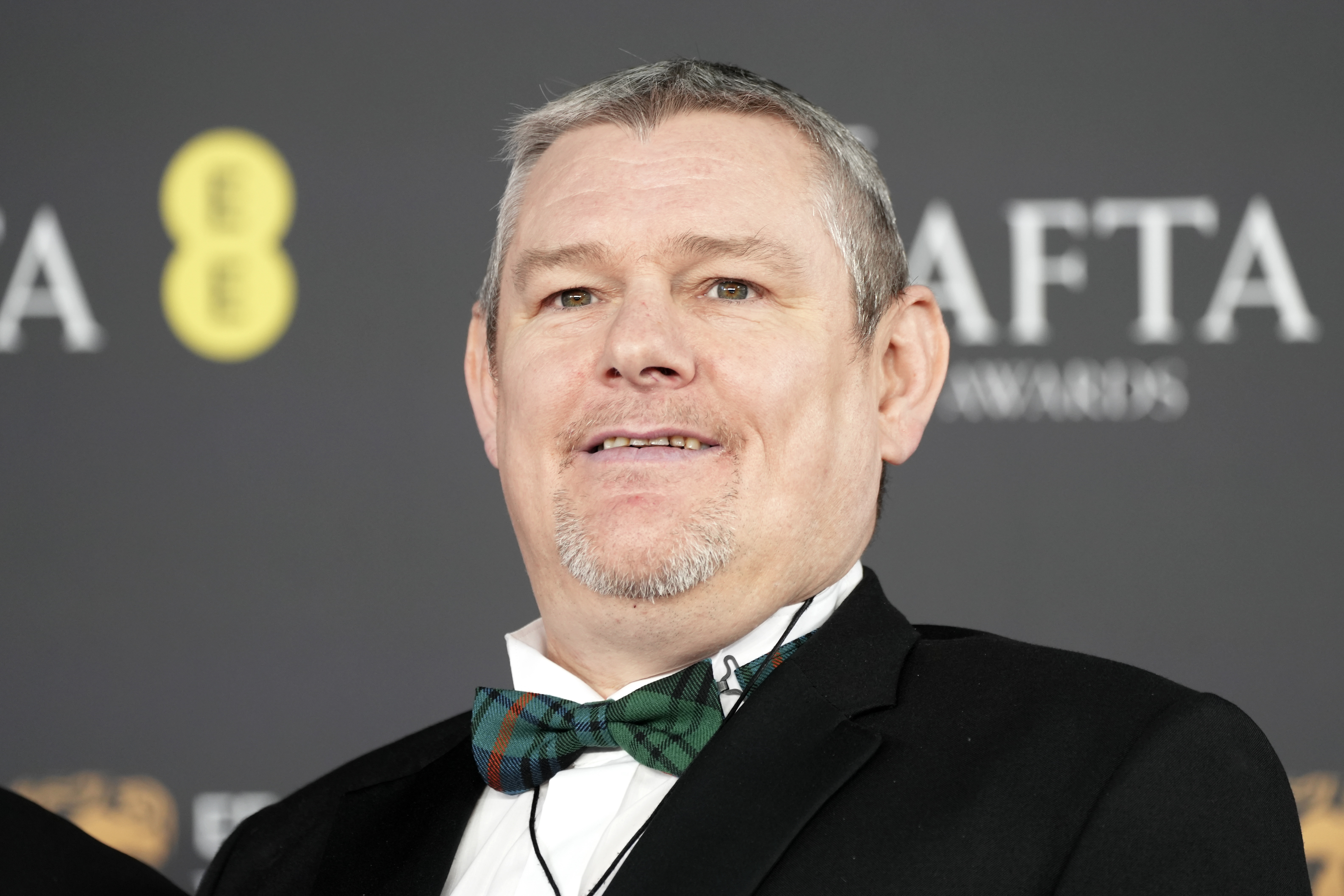 BAFTAs N-Word Slur Was 'Impossible Situation'