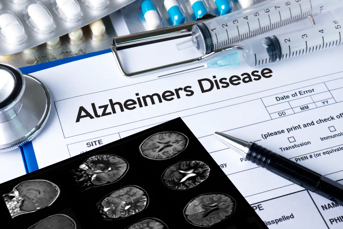 Scientists List Health Conditions That May Signal Alzheimer’s Years ...