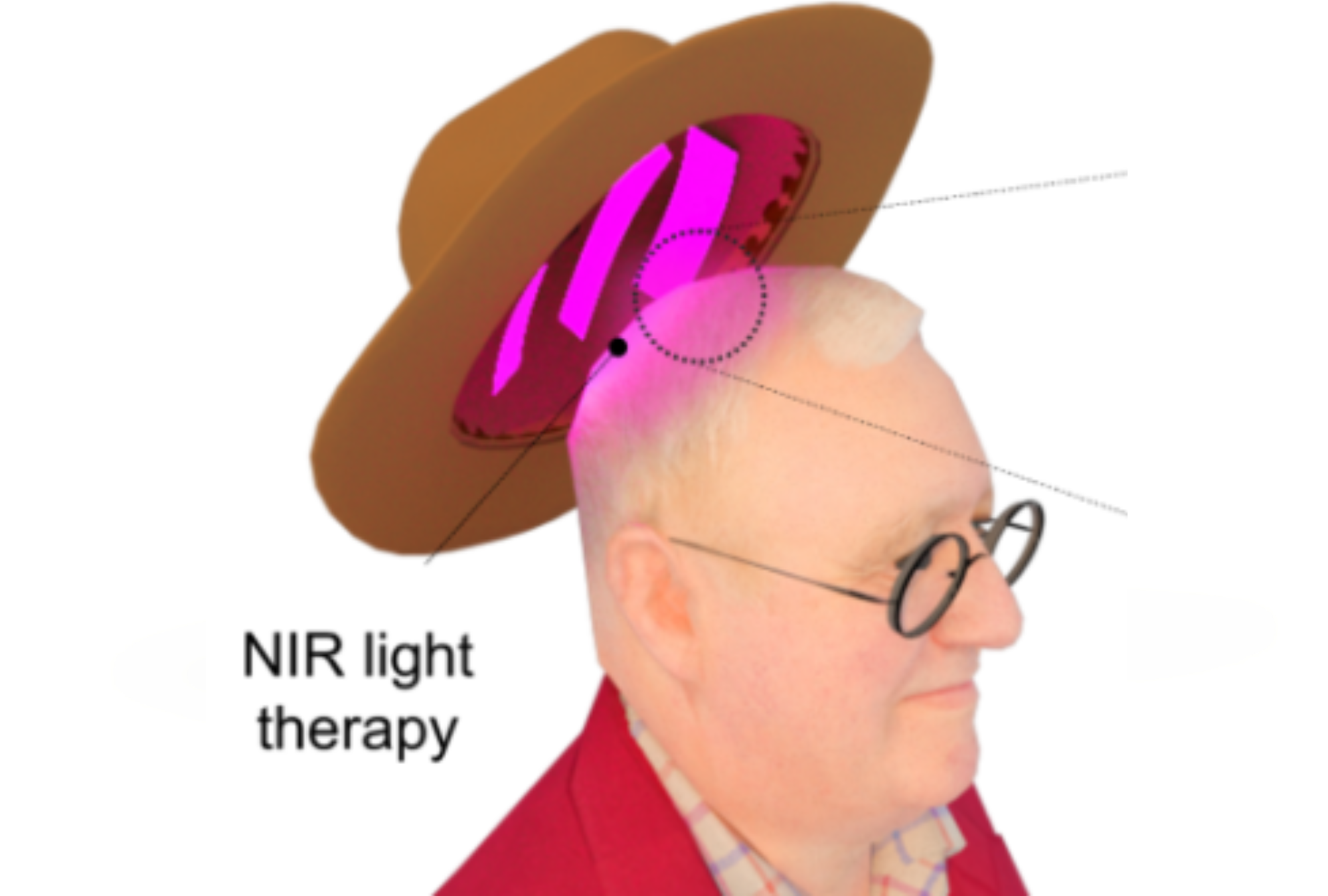 Scientists Reveal Hat That Could Help Prevent Hair Loss