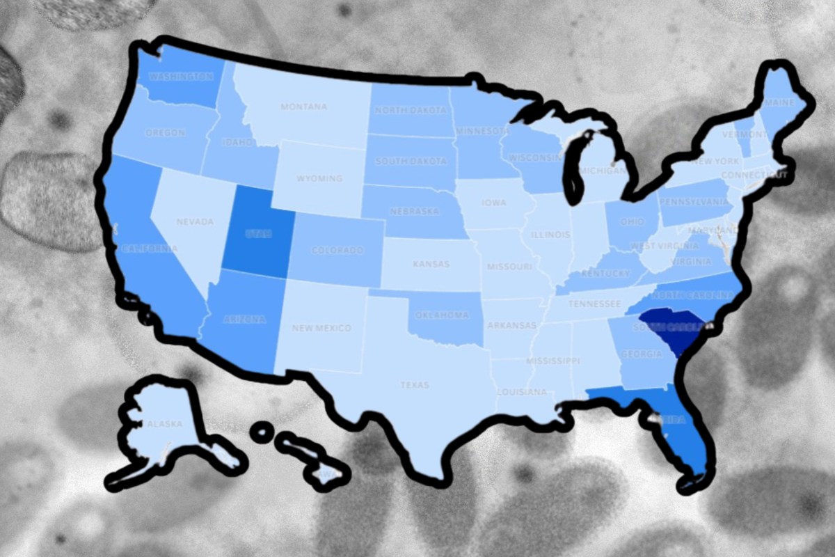 Map Shows Measles Outbreaks Surge Across United States