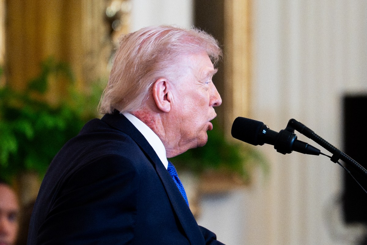 Arzt reagiert auf Foto von Donald Trumps Halsausschlag, das für Aufsehen ...