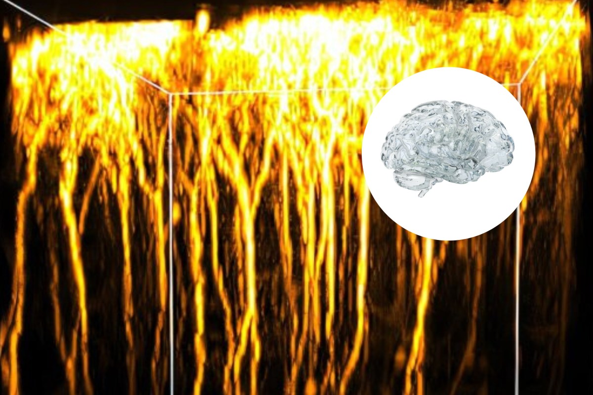 Scientists Make Live Brain Transparent - Newsweek