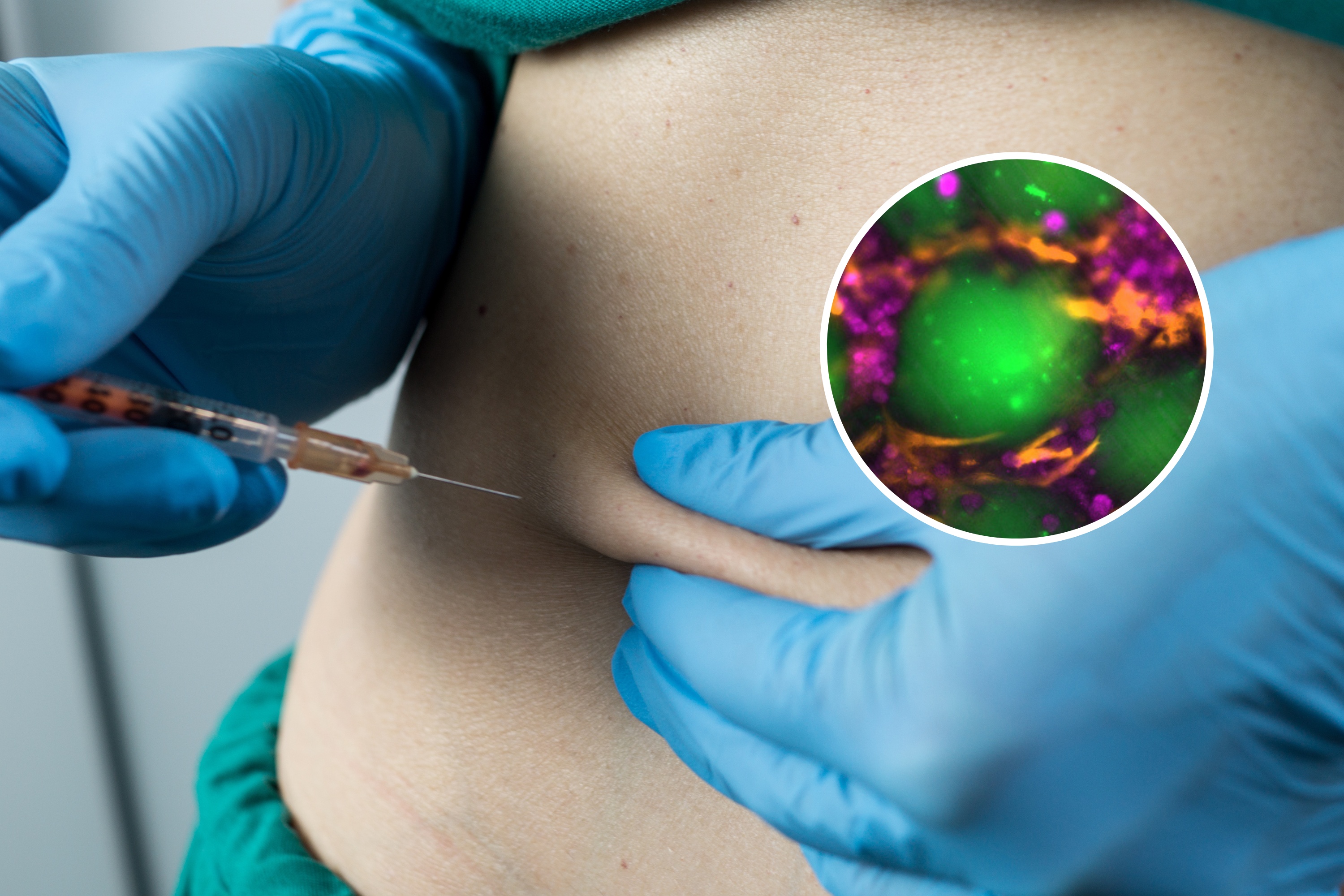 MIT Engineers Develop ‘Mini Livers’ That Can Be Injected Into the Body