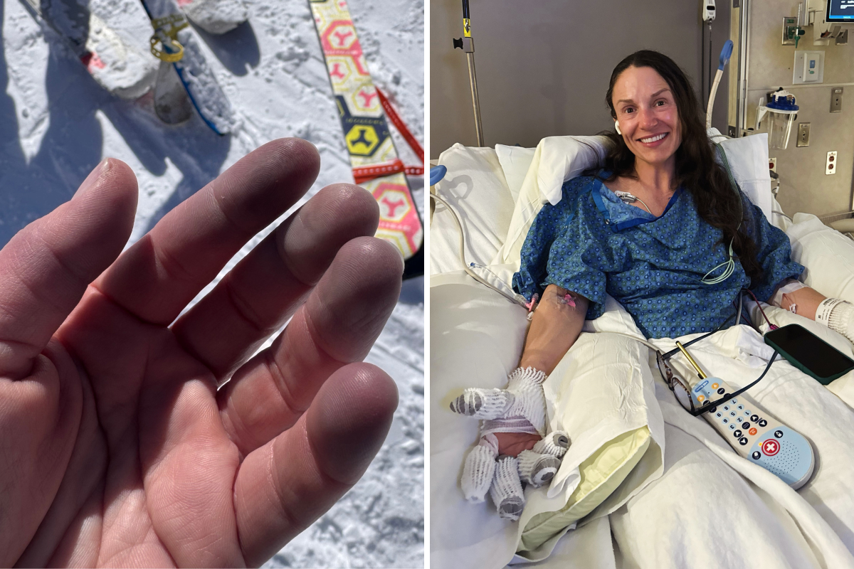 Skier takes gloves off during race—horror as she realizes life is in danger