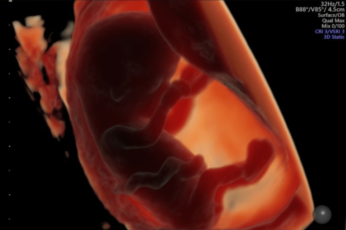 Alimentos comuns associados à menor fertilidade masculina e ao crescimento fetal mais lento