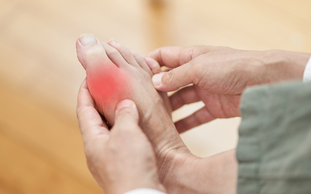 ‘Disease of Kings’ Rising in the US—and Millions of Americans Are at Risk