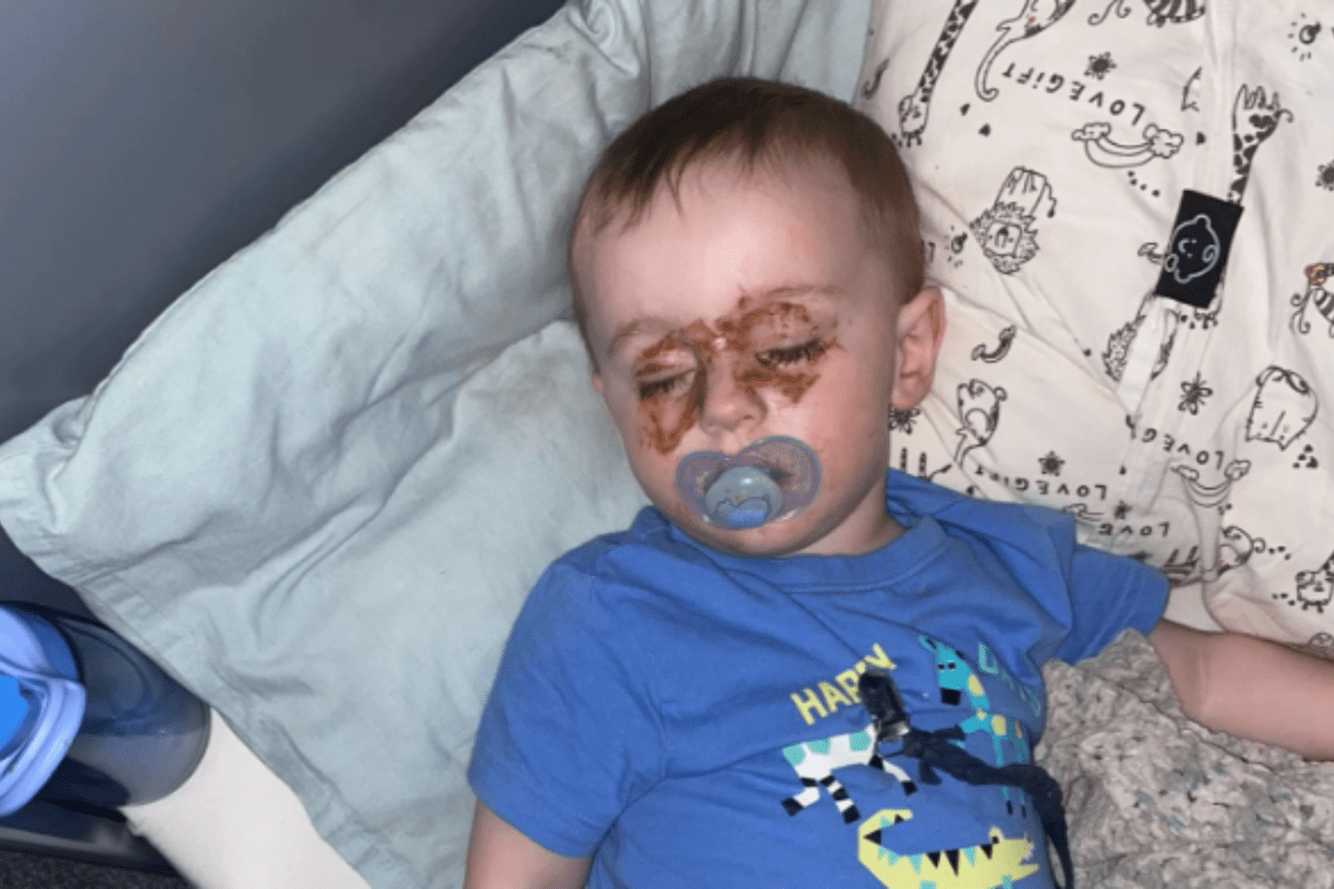 Mom checking on toddler at night spots strange marks on eyes—then realizes