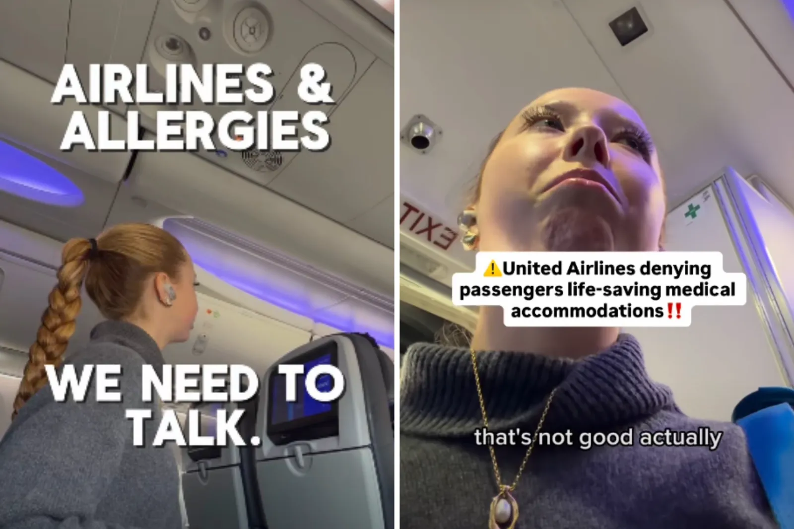 Woman With Peanut Allergy Boards Plane, Shock at What United Staff Tell Her
