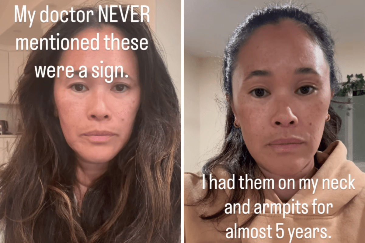 I Thought My Skin Tags Were Harmless, Then Came My Diagnosis