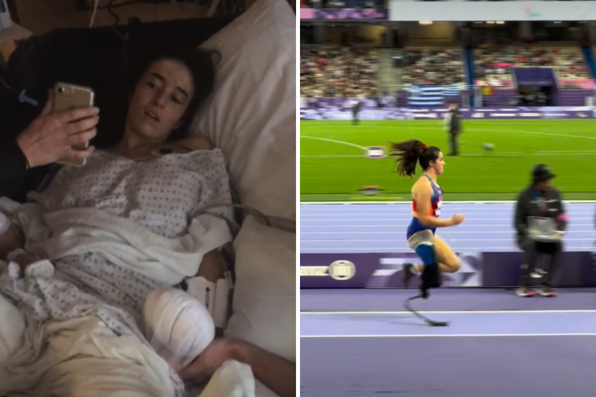 I lost my leg 13 days after getting married, then I accomplished my dream
