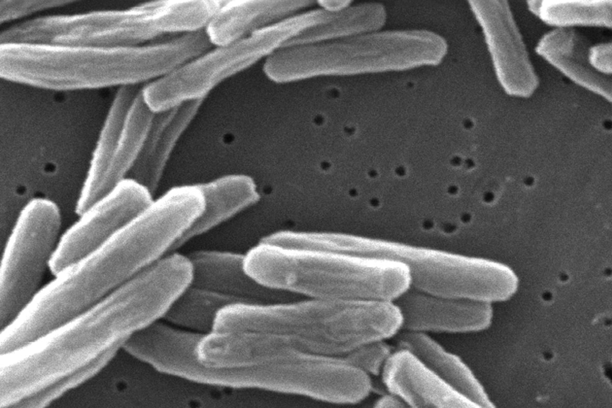 CDC Warns Large Tuberculosis Outbreaks Doubled in US Since Mid-2010s