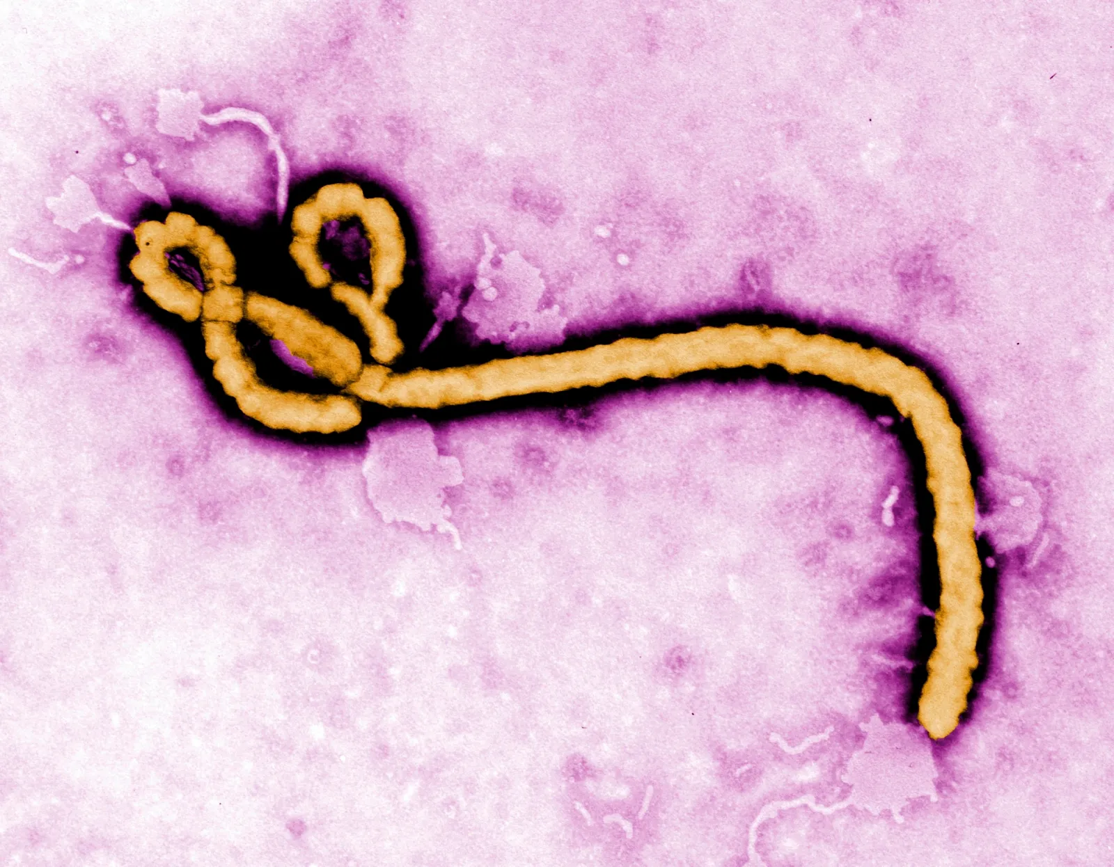 A colorized transmission electron micrograph image made available by the Centers for Disease Control and Prevention shows an Ebola virus virion. (Frederick Murphy/CDC via AP, File)