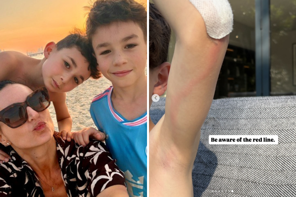 My Son Scraped His Arm. I Almost Missed the Warning Sign That It Was Life-Threatening