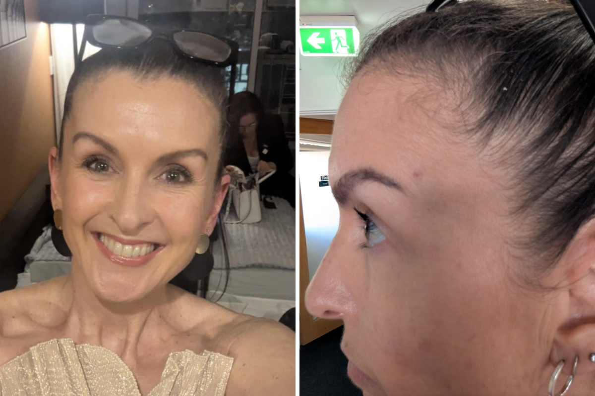 I Went for a Skin Check—They Found Melanoma Where I'd Never Even Looked
