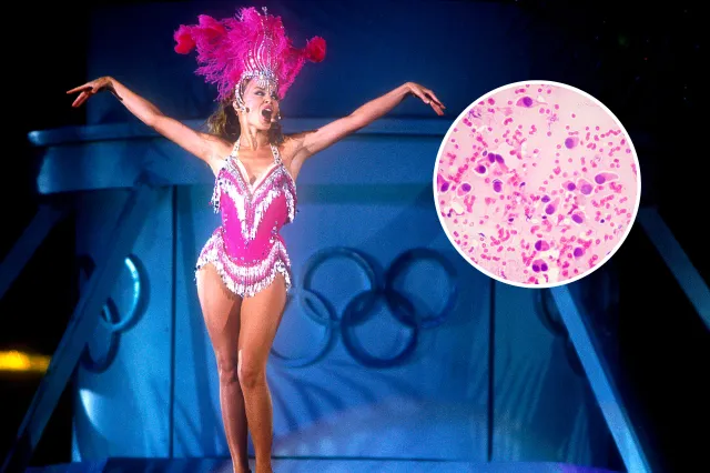 From left: Kylie Minogue performs in Sydney Australia on September 1, 2000; and microscopic image of breast cancer is seen.