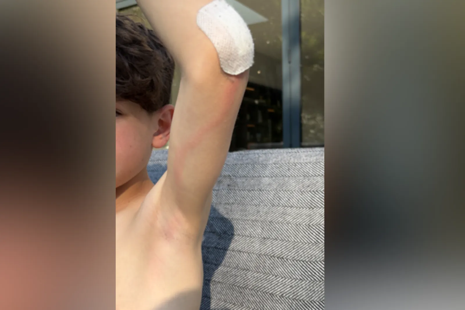 When Samantha Silver saw this red line on her son's arm, she knew it was an emergency.