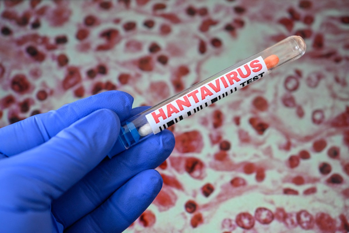 Hantavirus Cases Live Tracker: Map Shows Where Outbreak Has Been Detected