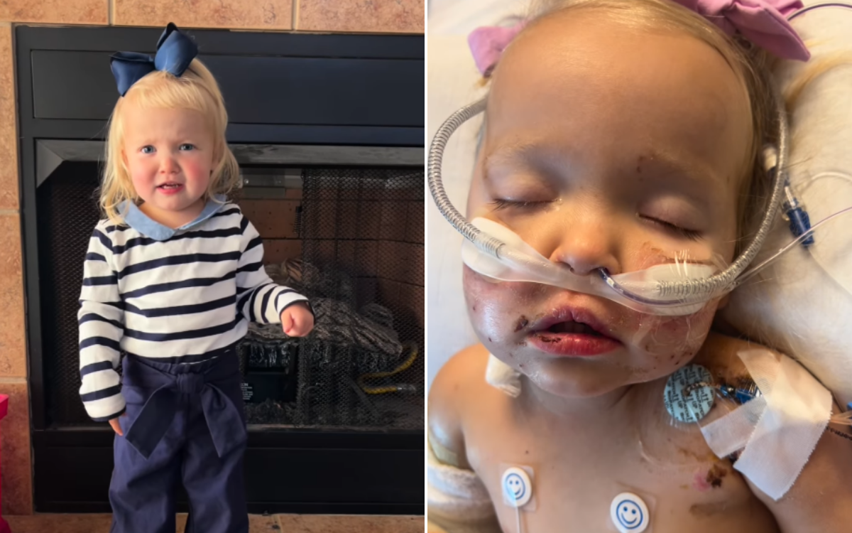 Tennessee Toddler Loses Both Legs After Rapid Sepsis Onset