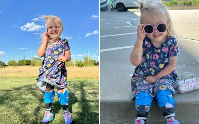 Mady happy and living life with help from her prosthetic legs.