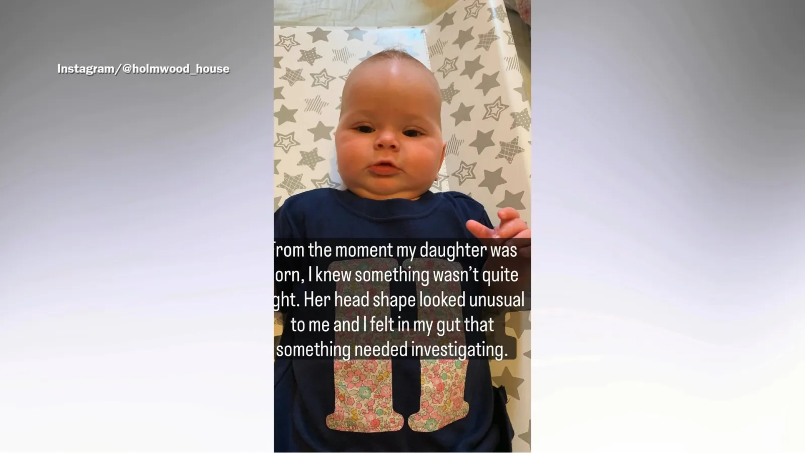 Doctors Dismissed My Newborn’s Head Shape—Then Came Terrifying ...
