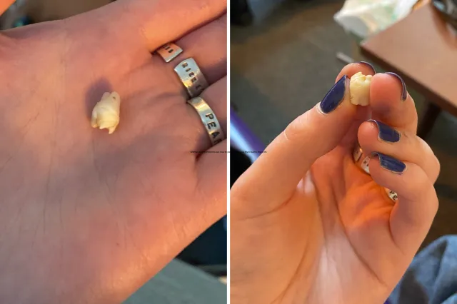 Oli tient la dent trouvée dans la tumeur de sa mère.