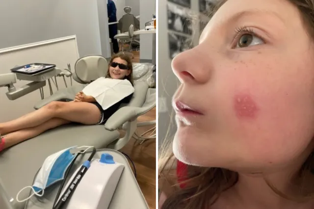 Emmy in the dentist's office and the red mark on her cheek.