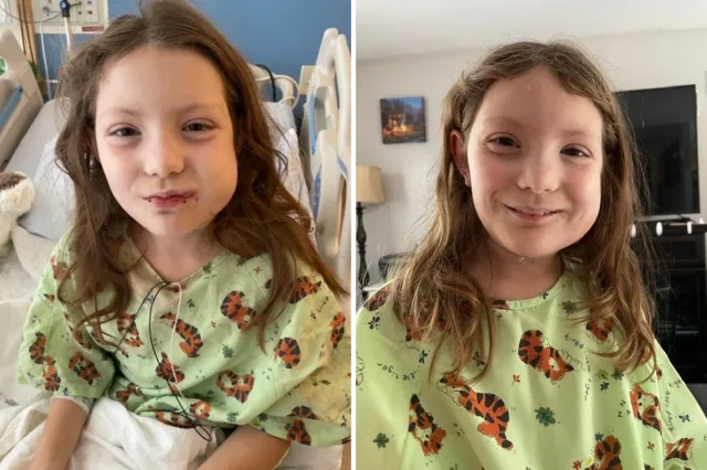 Emmy after surgery to remove the tumor.