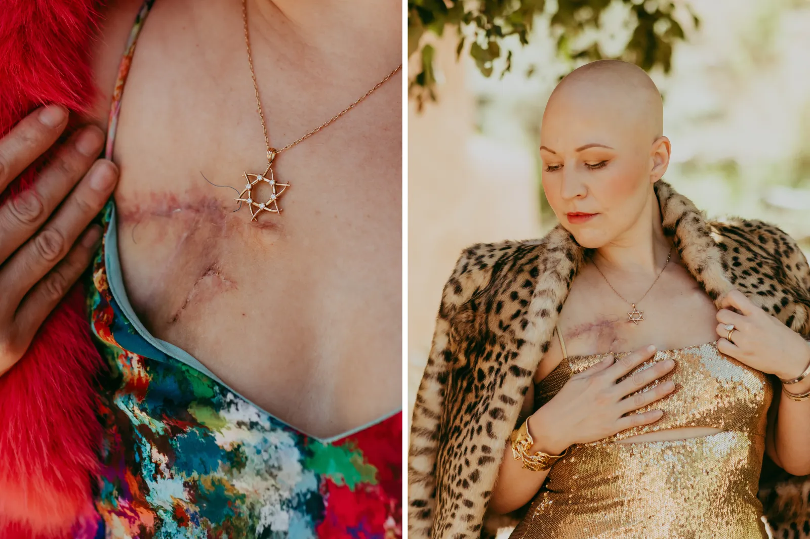 From left: Tegan Kline shows surgery scars close up; and while standing outside.