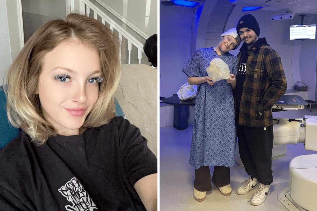 Doctors Told Me I Had Cancer in My Jaw at 22—But Worse Was Still to Come
