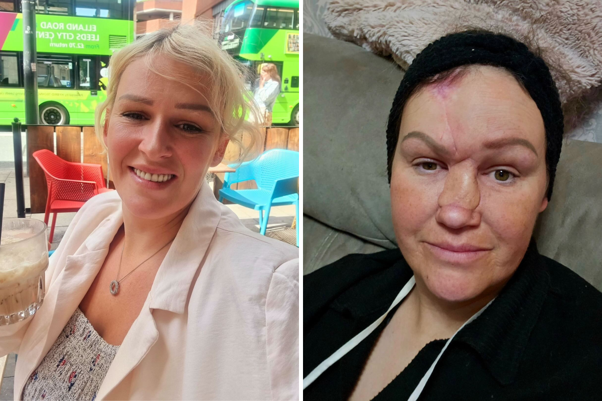 I Thought I’d Broken My Nose—But Scans Found Something Far More Terrifying