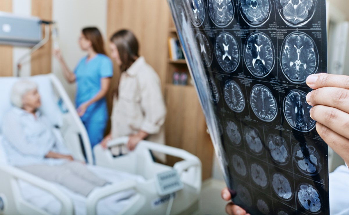 New Trigger for Alzheimer& 039;s Disease May Have Been Found