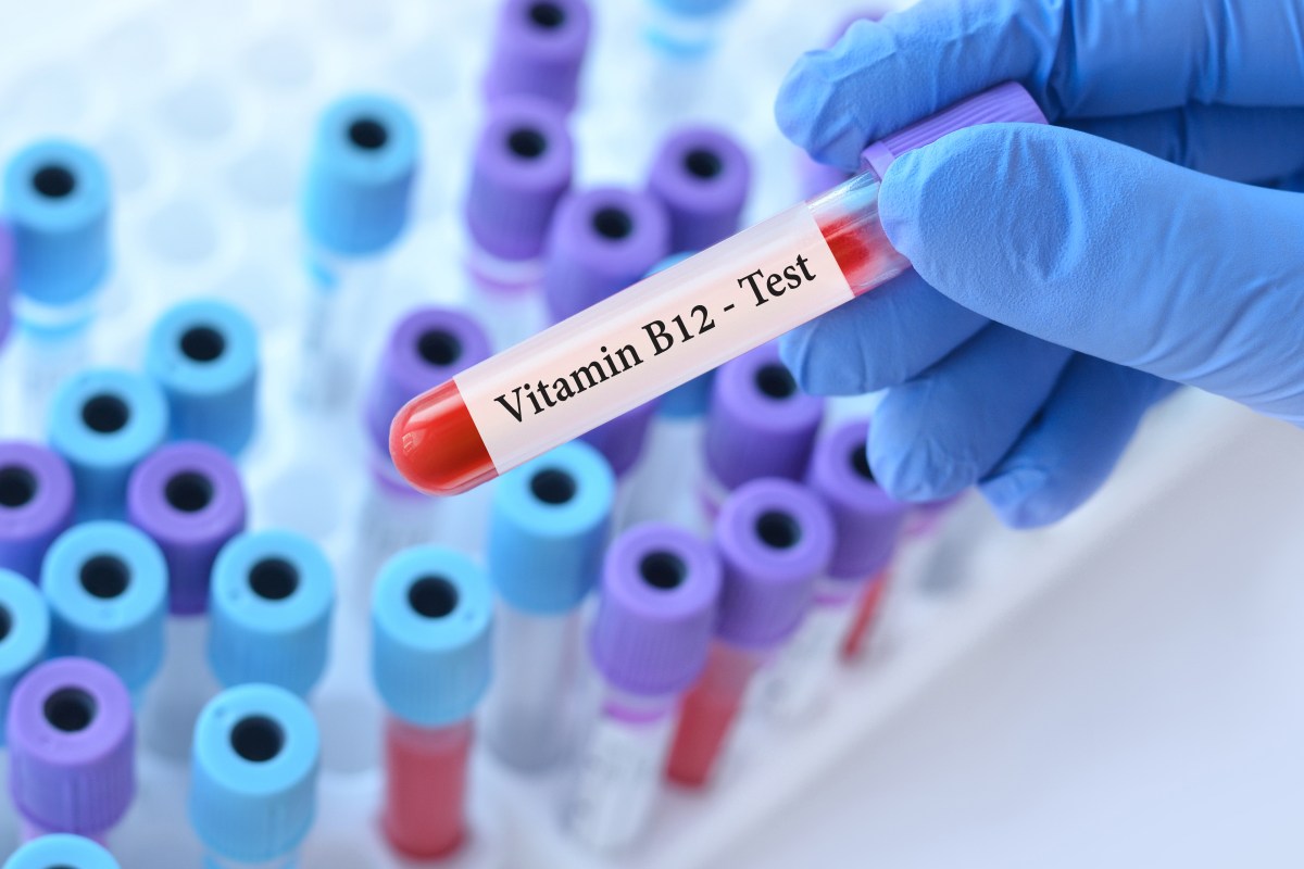 Vitamin B12 Deficiency Can Mimic Aging