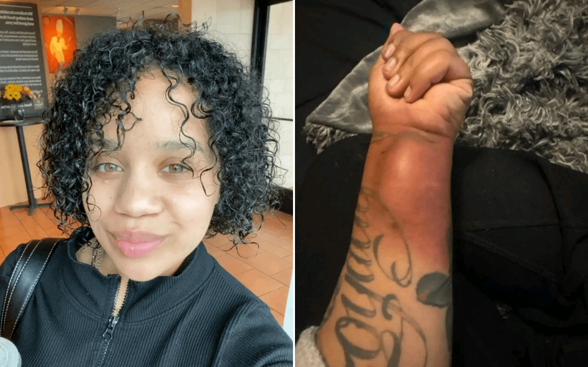 Woman Had 28 Tumors on Her Body–Then One Began Growing at a Worrying Rate