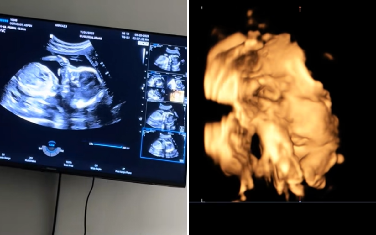 The Scan Showed Something & 039;Unusual& 039;&mdash;Doctor&rsquo;s Next Words Stunned Mom-To-Be