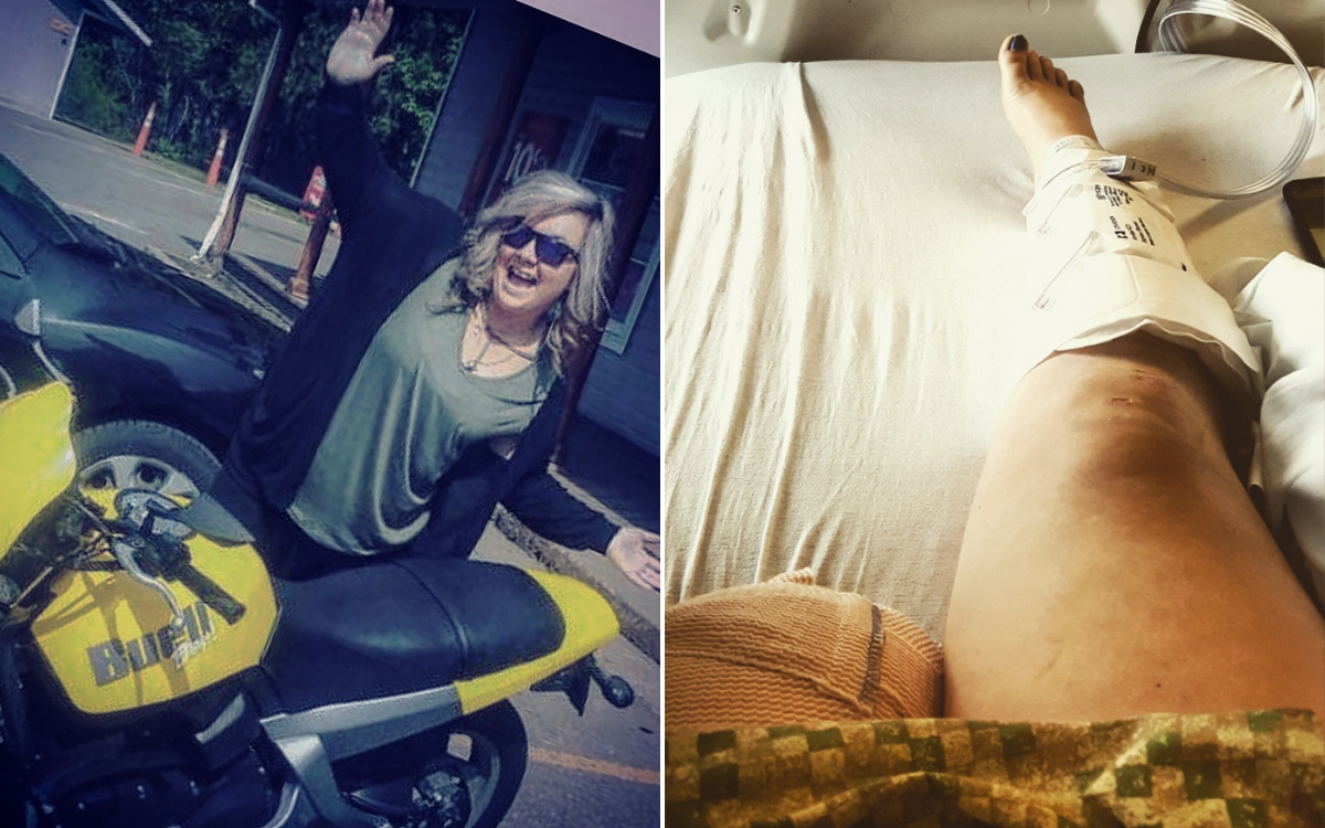 Mom Was Riding Motorcycle, Then Wakes to Sight of Her Own Limbs on Road