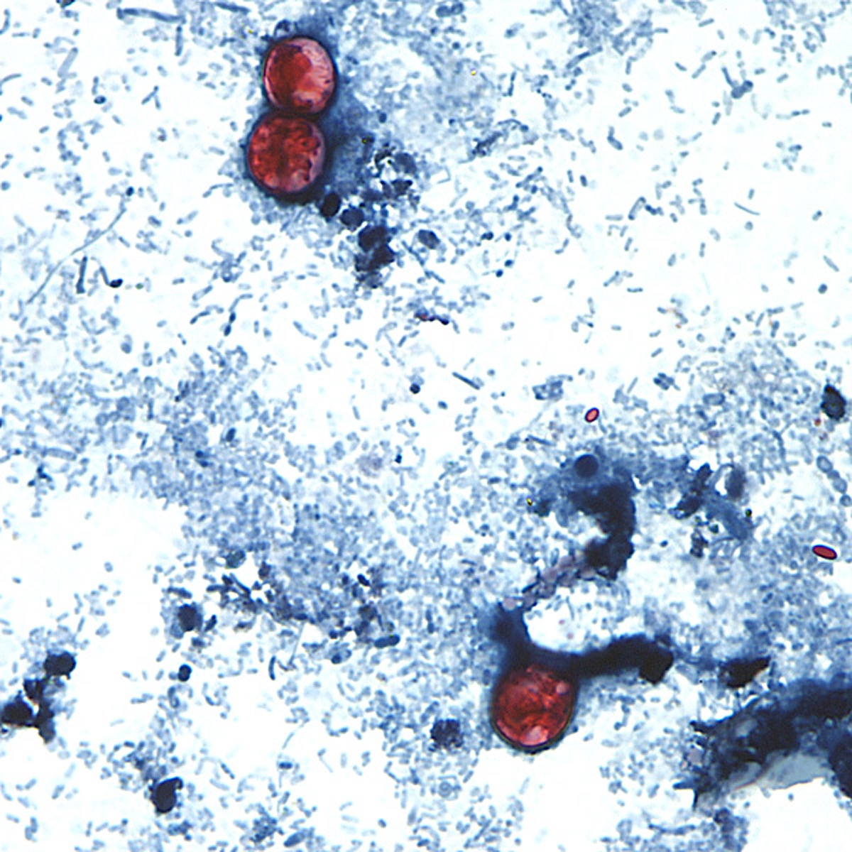 Medicine to Treat ‘Explosive’ Diarrhea Outbreaks Could Cause More Diarrhea Medicine to Treat ‘Explosive’ Diarrhea Outbreaks Could Cause More Diarrhea