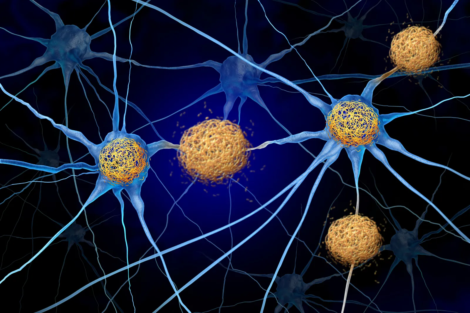 A Hidden Vulnerability in the Brain May Help Alzheimer’s Spread