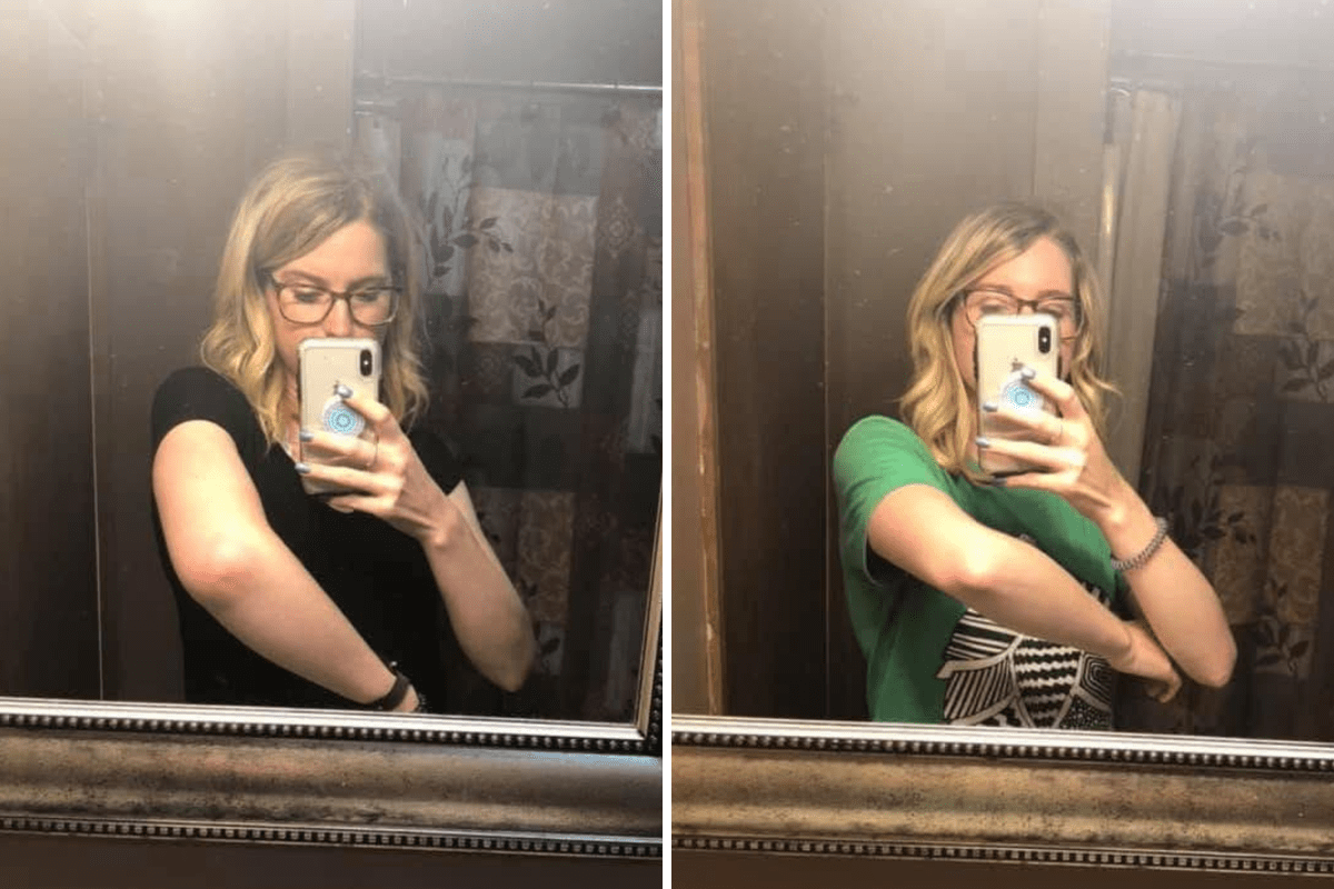 Woman Almost Ignored Arm Pain After Workout—Then Comes Terrifying Diagnosis