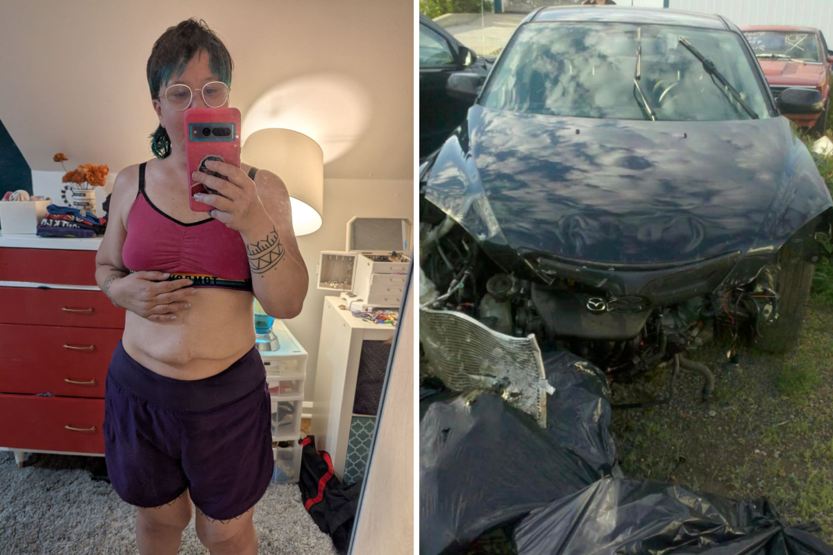 Couple Rushed to Hospital After Crash—Then CT Scan Reveals Something Else