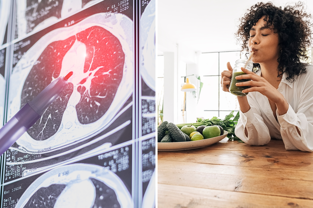 Healthy Young Non-Smokers Are Getting Lung Cancer—Researchers Have a Theory