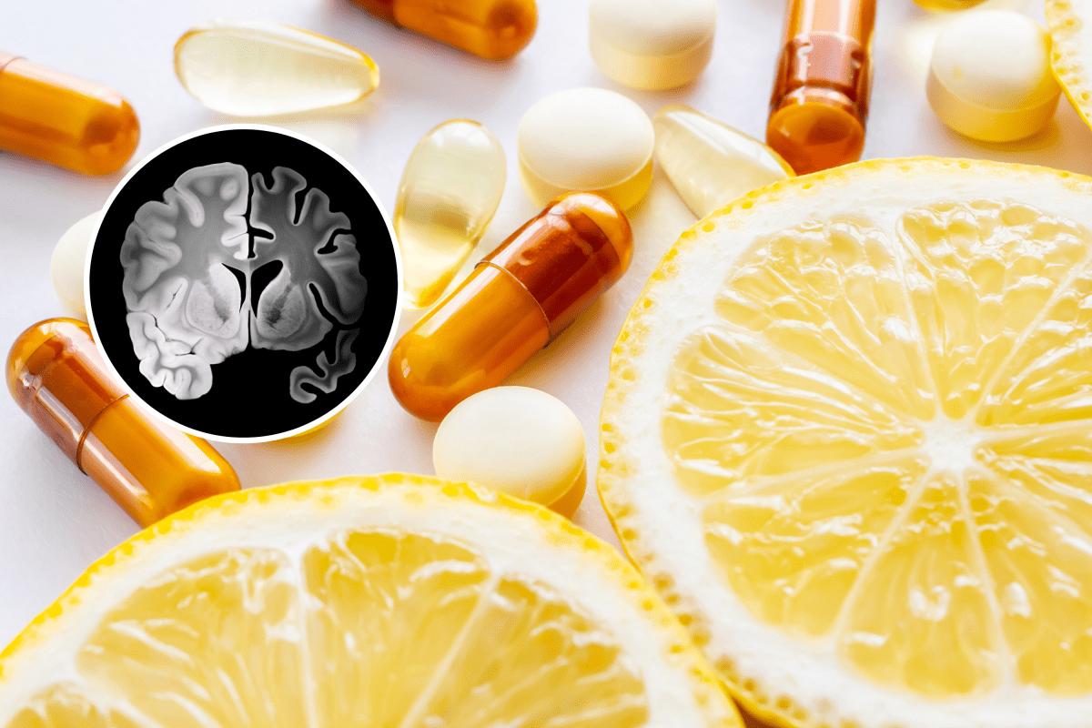 Low Vitamin C Levels Linked to Less Gray Matter in Brain