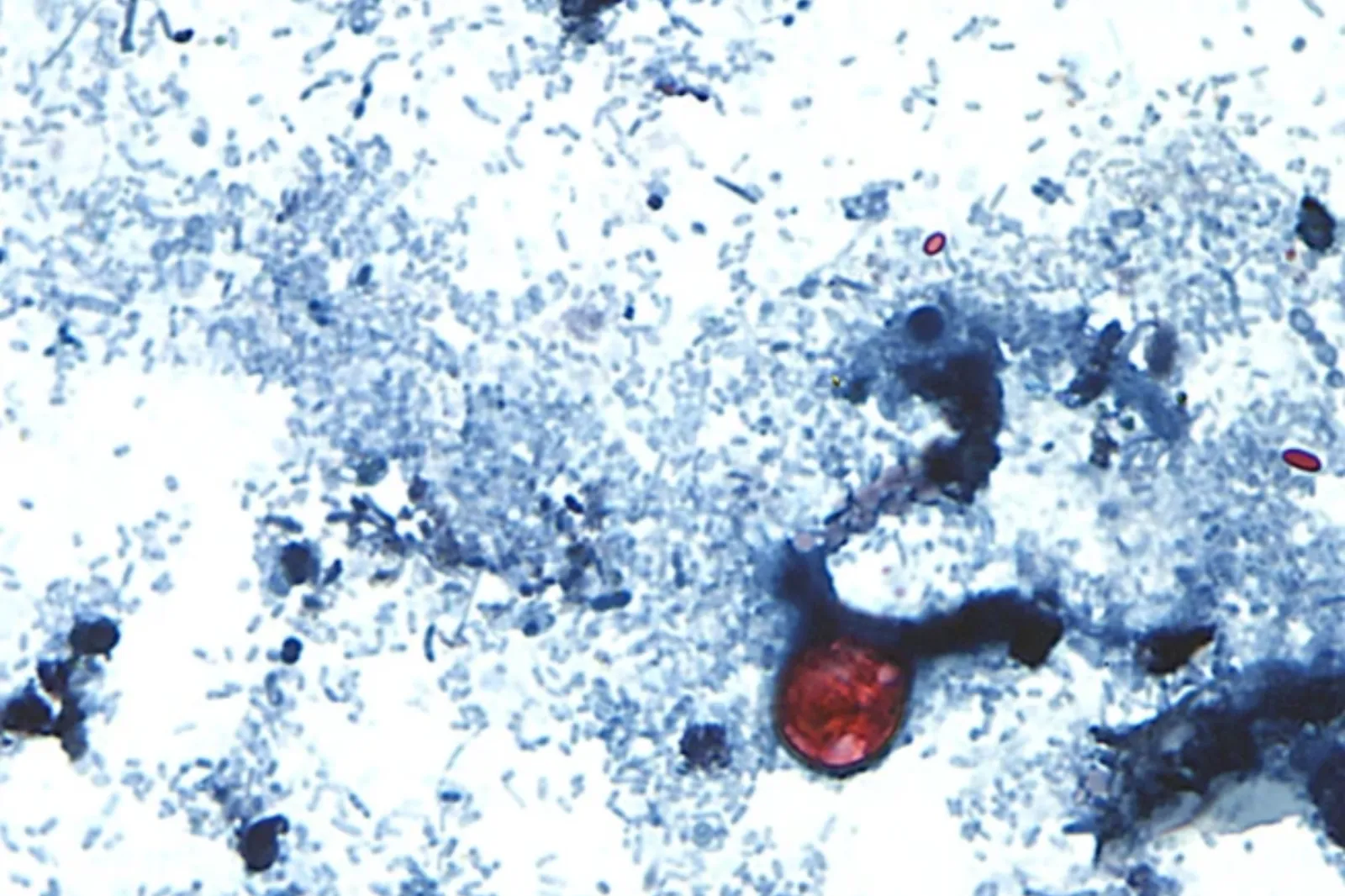 This undated photo taken through a microscope provided by the CDC shows Cyclospora cayetanensis oocysts found in a fresh stool sample which had been prepared with a formalin solution and stained with safranin.