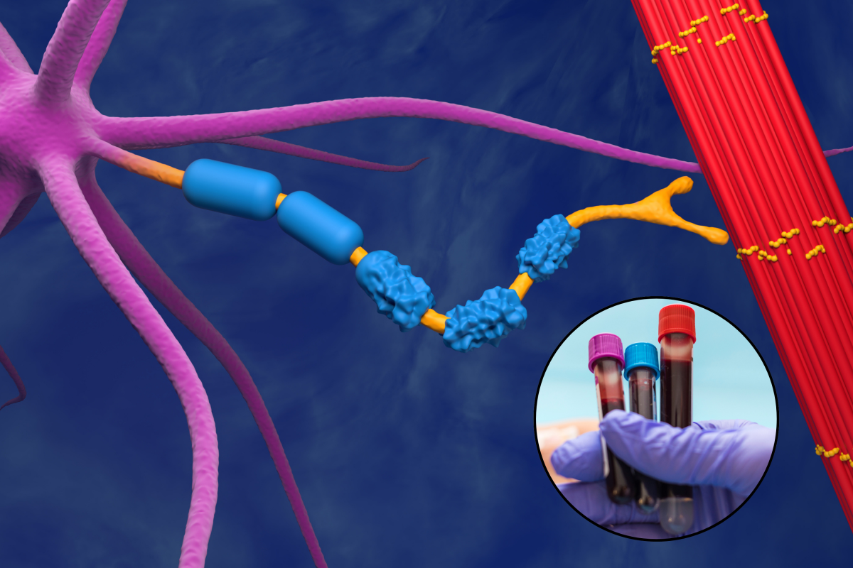 One Simple Test May Detect ALS Years Before It Starts