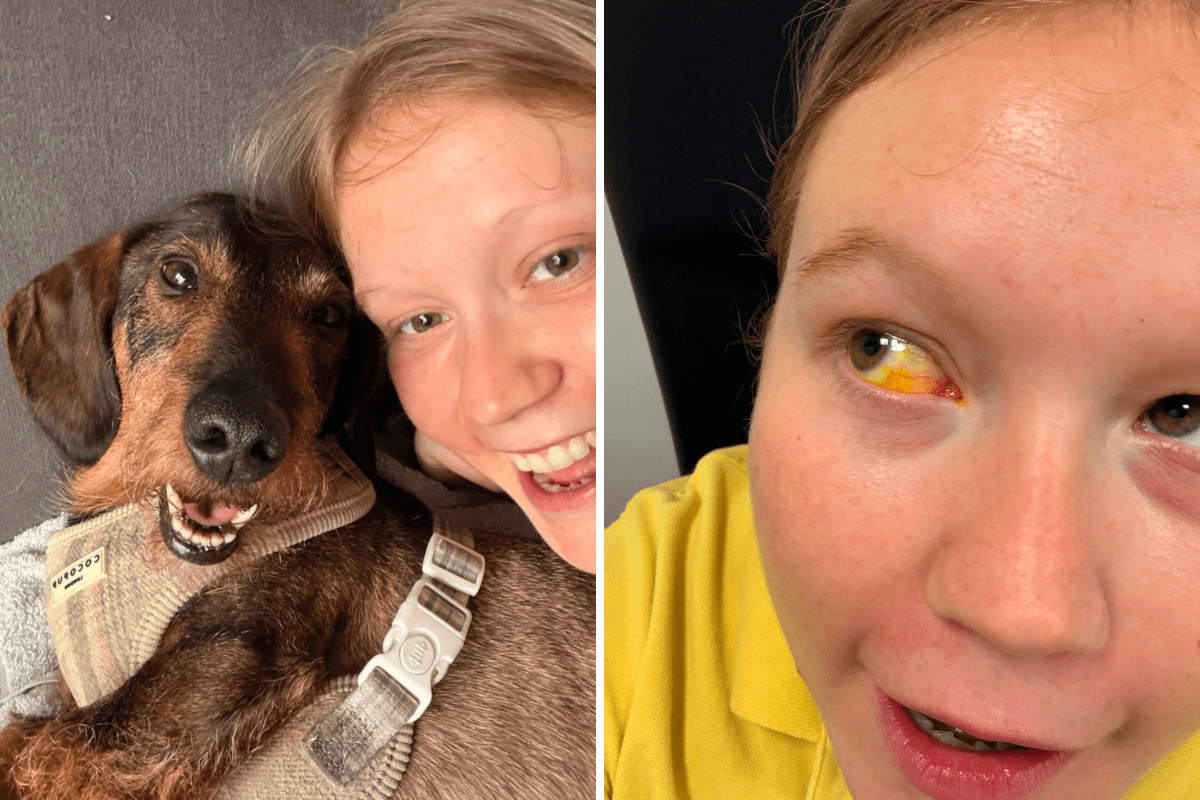 Woman 'Broke Eye' After Making Major Crying Mistake When Grieving Dog
