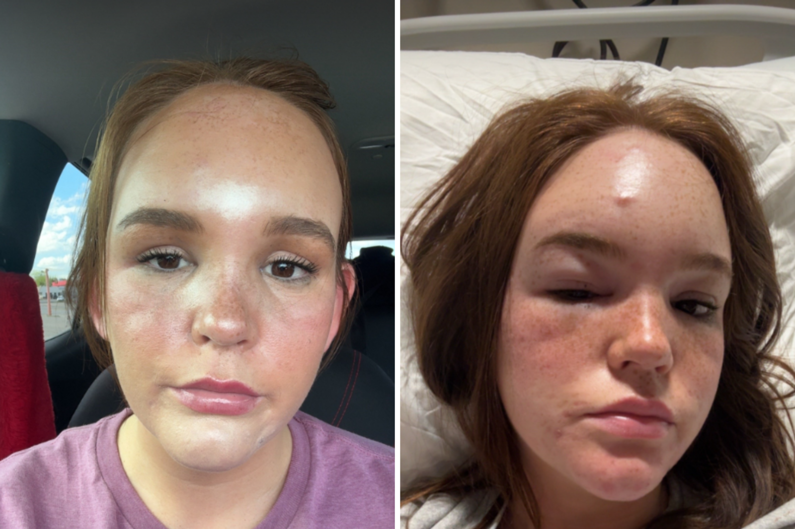 Oklahoma Woman Faces Repeated Hospitalizations After Forehead Lump